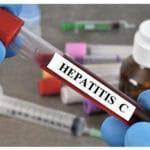 Hepatitis C